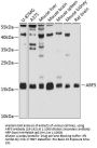 ARF5 Antibody