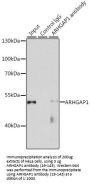 ARHGAP1 Antibody