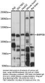 INPP5B Antibody