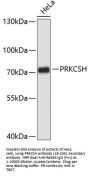 PRKCSH Antibody
