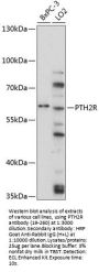 PTH2R Antibody