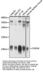 S100A6 Antibody, KO Validated