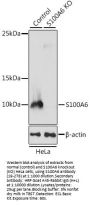 S100A6 Antibody, KO Validated