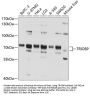 TRIOBP Antibody
