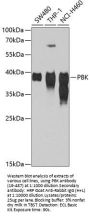 SPK Antibody
