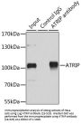 ATRIP Antibody