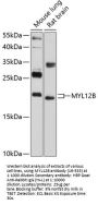 MYL12B Antibody
