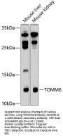 TOMM6 Antibody