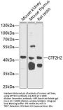 GTF2H2 Antibody