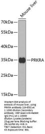 PRKRA Antibody