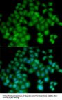 TMSB4X Antibody