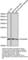 PLA2G1B Antibody