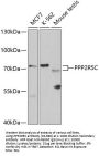 PPP2R5C Antibody