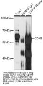 CDK8 Antibody, KO Validated