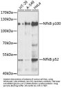NFkB p100 / p52 Antibody