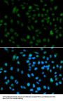 WHSC1L1 Antibody