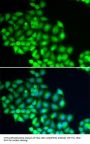 ERCC2 Antibody