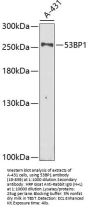 53BP1 Antibody