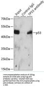 p53 Antibody