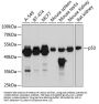 p53 Antibody