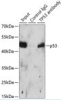 p53 Antibody