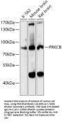 PRKCB Antibody