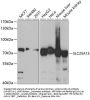 SLC25A13 Antibody