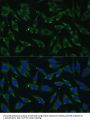DICER1 Antibody