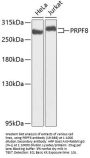PRPF8 Antibody