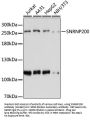 SNRNP200 Antibody