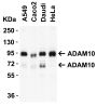 ADAM10 Antibody