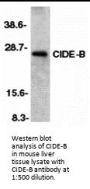 CIDE-B Antibody