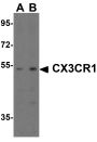 CX3CR1 Antibody
