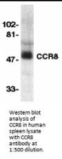 CCR8 Antibody