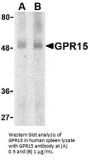 GPR15 Antibody