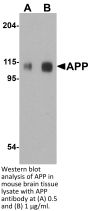 APP Antibody