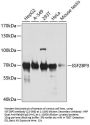 IGF2BP3 Antibody