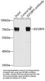 IGF2BP3 Antibody