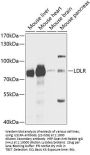 IL31RA Antibody