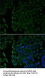 MSLN Antibody