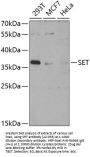 SET Antibody