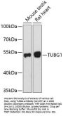TUBG1 Antibody