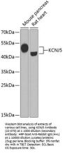 KCNJ5 Antibody