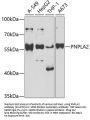 PNPLA2 Antibody