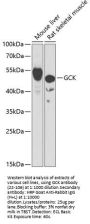GCK Antibody