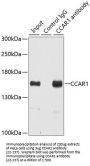 CCAR1 Antibody