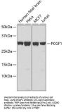PCGF1 Antibody