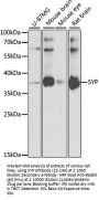 SYP Antibody