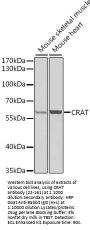 CRAT Antibody