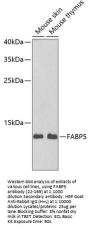 FABP5 Antibody